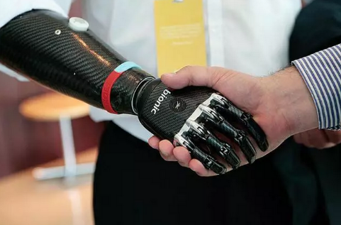 上肢截肢后安裝河南假肢注意的事項(xiàng)(圖1) 上肢截肢后安裝河南假肢注意的事項(xiàng)(圖1)