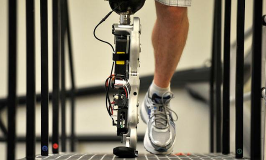 患者安裝河南假肢時(shí)需要注意事項(xiàng),如何區(qū)分假肢(圖1) 患者安裝河南假肢時(shí)需要注意事項(xiàng),如何區(qū)分假肢(圖1)