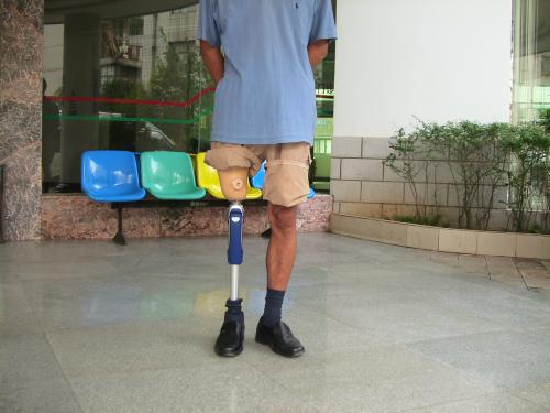 一個(gè)好的假肢廠家從哪些方面進(jìn)行評(píng)價(jià)(圖1) 一個(gè)好的假肢廠家從哪些方面進(jìn)行評(píng)價(jià)(圖1)