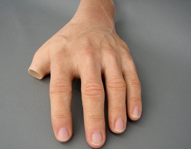 河南安裝假肢好的醫院在哪力康假肢怎么樣呢(圖1) 河南安裝假肢好的醫院在哪力康假肢怎么樣呢(圖1)