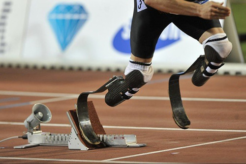 正確佩戴假肢對(duì)截肢患者“百利無(wú)一害”(圖2) 假肢