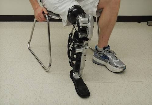 如何理性對待避免安裝劣質(zhì)假肢?(圖1) 假肢